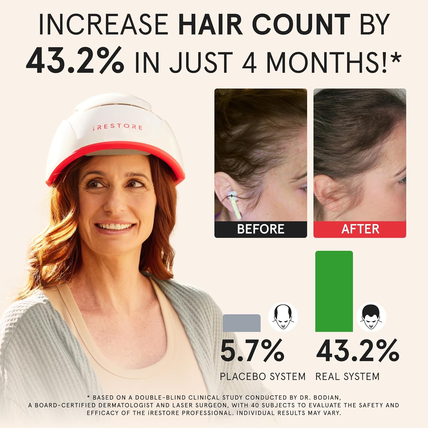 iRestore Professional Light Hair Growth System, 282 Light & LEDs